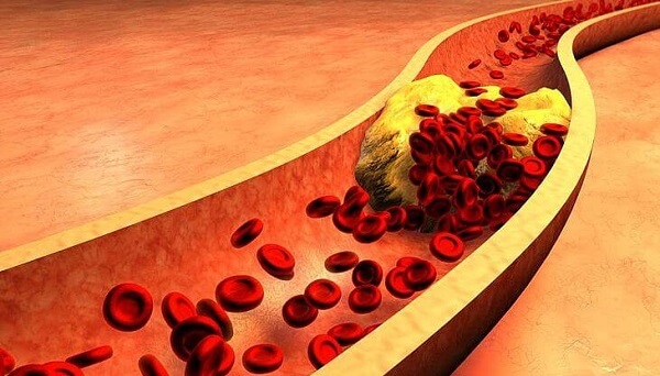 colesterol bun vs rau